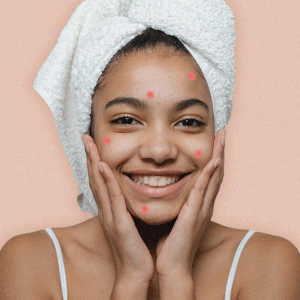 Tried-and-tested: The best pimple treatments for efficient acne-busting action